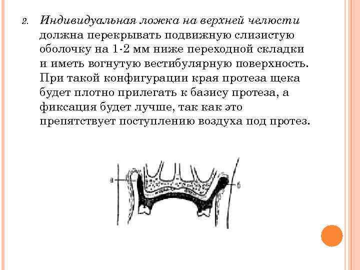 Припасовка индивидуальной ложки на верхней челюсти проводят по следующему плану