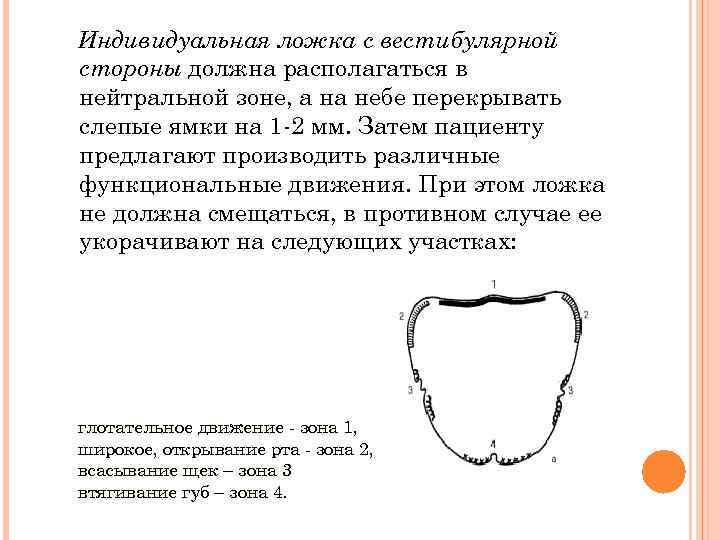 Припасовка индивидуальной ложки на верхней челюсти проводят по следующему плану