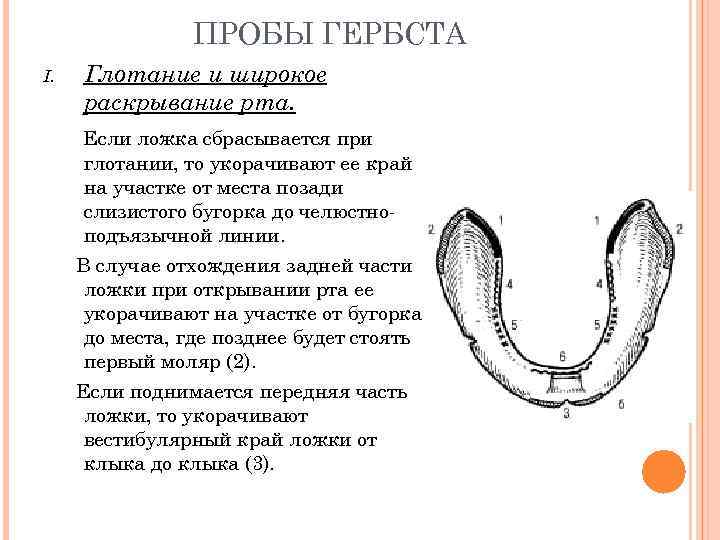 Припасовка индивидуальной ложки на верхней челюсти проводят по следующему плану