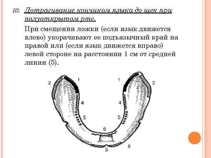 III.  Дотрагивание кончиком языка до щек при  полуоткрытом рте.   При