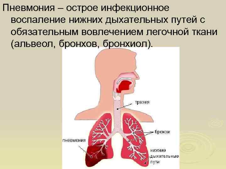 Пневмония – острое инфекционное воспаление нижних дыхательных путей с обязательным вовлечением легочной ткани (альвеол, Пневмония – острое инфекционное воспаление нижних дыхательных путей с обязательным вовлечением легочной ткани (альвеол,