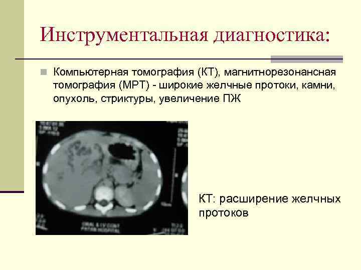 Инструментальная диагностика: n Компьютерная томография (КТ), магнитнорезонансная  томография (МРТ) - широкие желчные протоки,