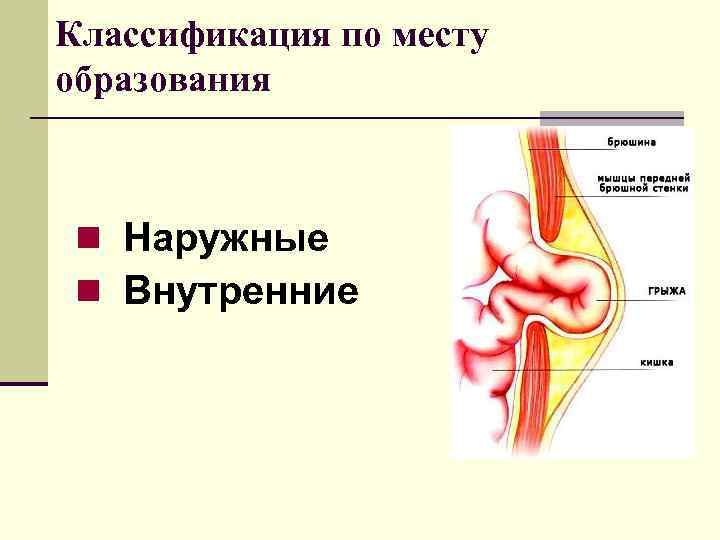 Классификация по месту образования  n Наружные n Внутренние 