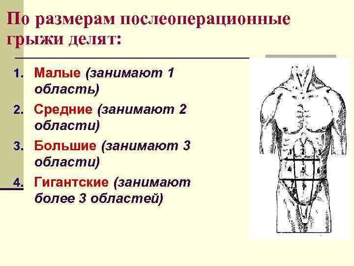 По размерам послеоперационные грыжи делят: 1. Малые (занимают 1  область) 2. Средние (занимают