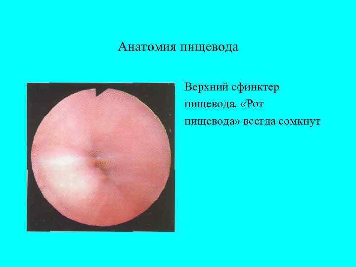 Анатомия пищевода  Верхний сфинктер   пищевода.  «Рот   пищевода» всегда