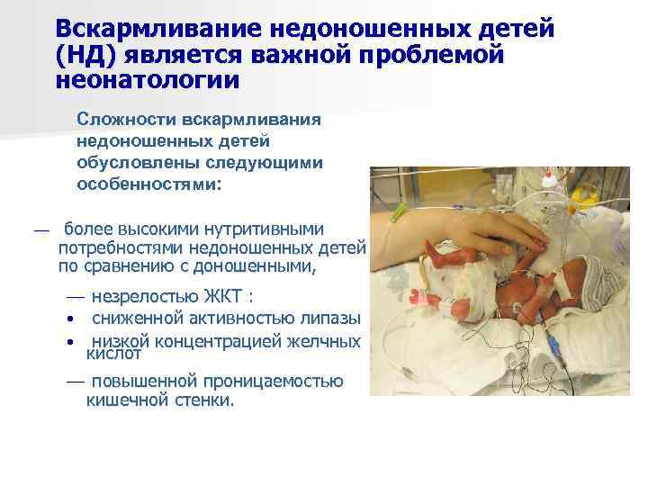  Вскармливание недоношенных детей  (НД) является важной проблемой  неонатологии Сложности вскармливания недоношенных