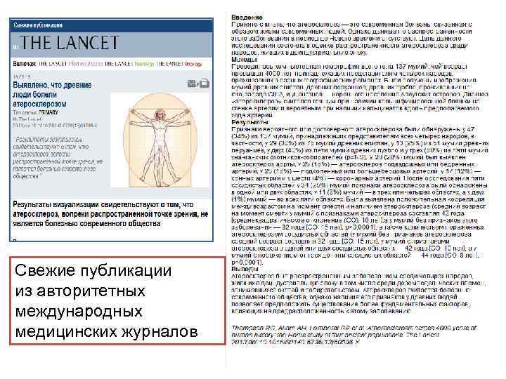 Свежие публикации из авторитетных международных медицинских журналов 