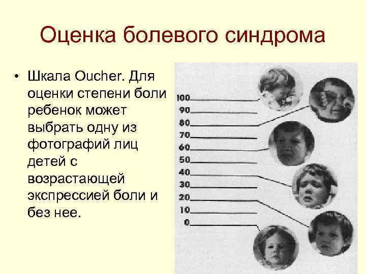 Оценка болевого синдрома • Шкала Oucher. Для оценки степени боли Оценка болевого синдрома • Шкала Oucher. Для оценки степени боли
