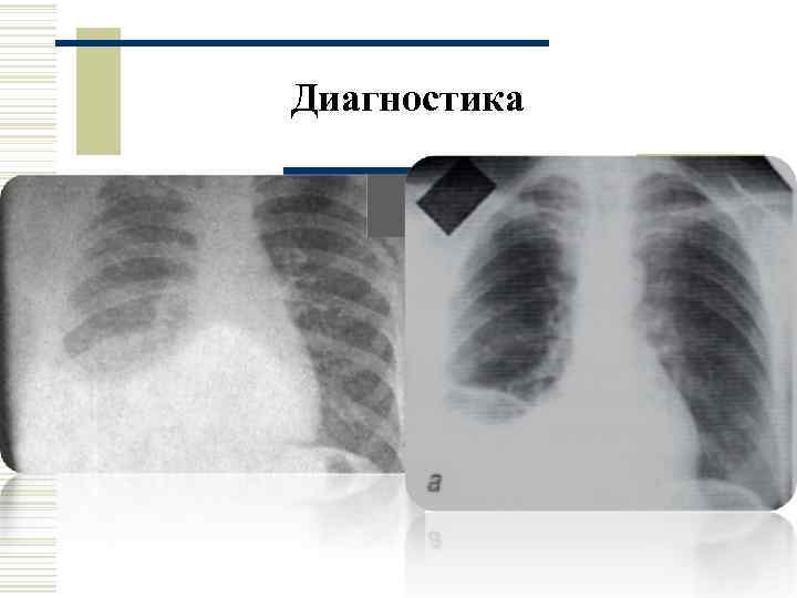 Диагностика 