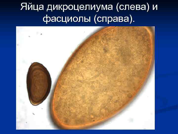 Яйца дикроцелиума (слева) и фасциолы (справа). 