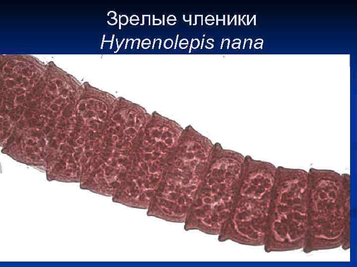 Зрелые членики Hymenolepis nana 