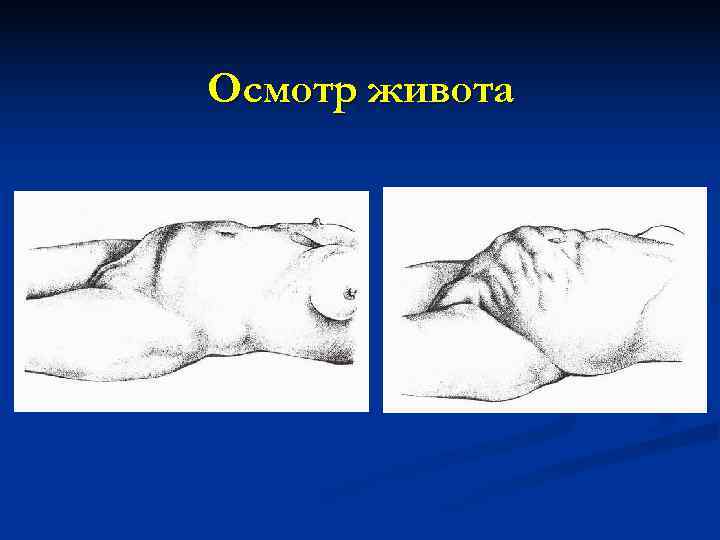 Осмотр живота 