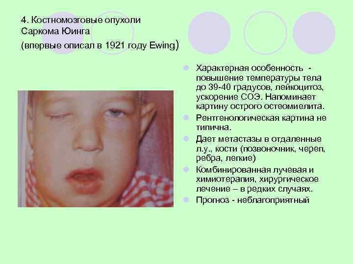 Nirmala S, Nuvvula S, Kumar K, Babu M, Chilamakuri S. Osteosarcoma of mandible in