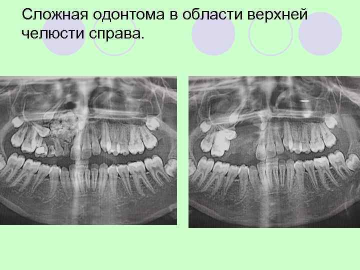 Девочка, 13 лет. на этапах лечения 