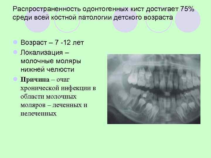 Этапы щадящей цистотомии 