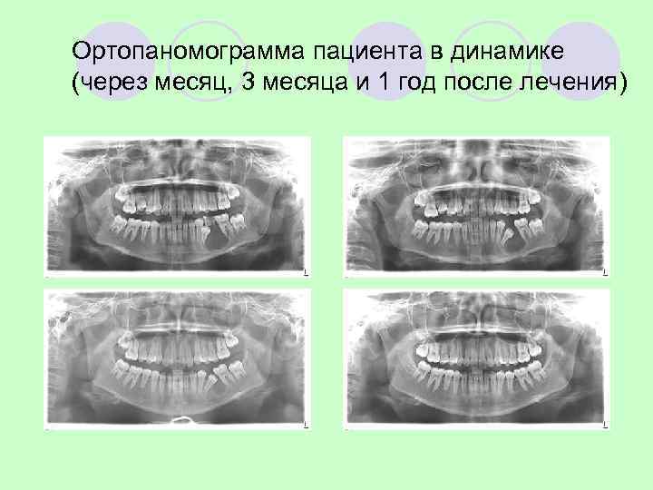 Системный обзор (25 исследований 2004 -2013) – эффективность хемолюминесценции (Vizi. Lite®, Vizi. Lite® Plus
