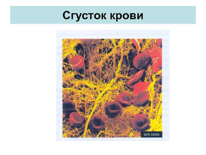 Сгусток крови 