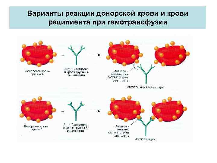 Варианты реакции донорской крови и крови реципиента при гемотрансфузии 