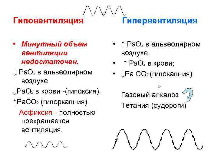 Пароксизмальная активность на фоне гипервентиляции