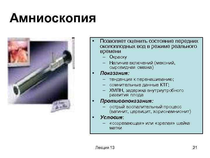 Амниоскопия  • Позволяет оценить состояние передних   околоплодных вод в режиме реального