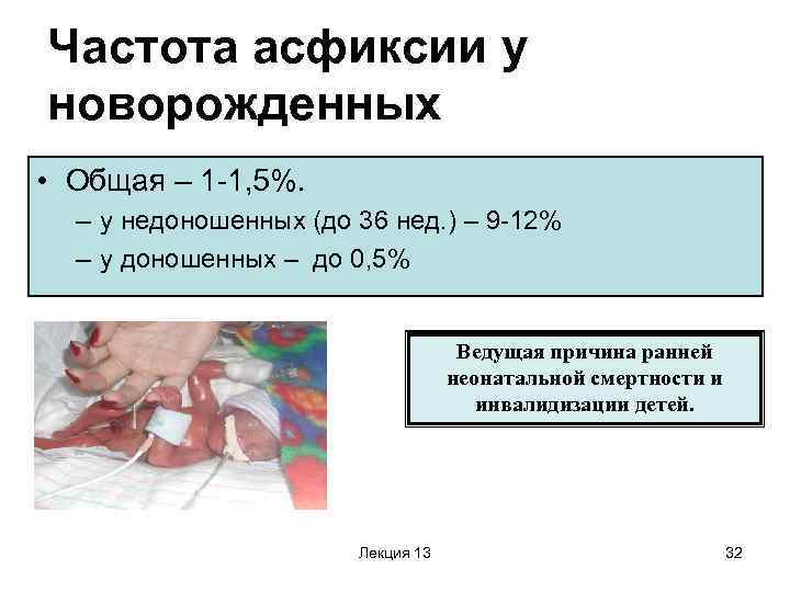 Частота асфиксии у новорожденных • Общая – 1 -1, 5%.  – у недоношенных