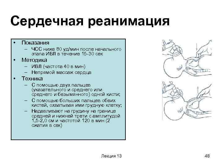 Сердечная реанимация •  Показания – ЧСС ниже 80 уд/мин после начального  этапа