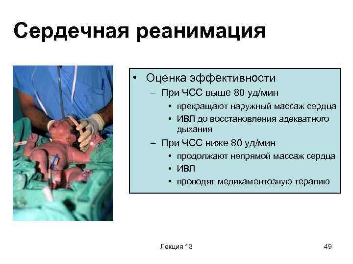 Сердечная реанимация  • Оценка эффективности  – При ЧСС выше 80 уд/мин 