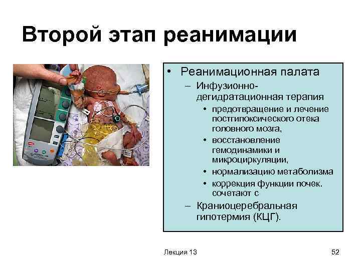 Второй этап реанимации   • Реанимационная палата   – Инфузионно-  