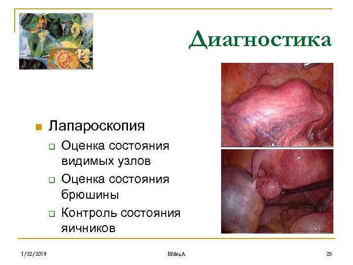     Диагностика  n Лапароскопия   q  Оценка состояния