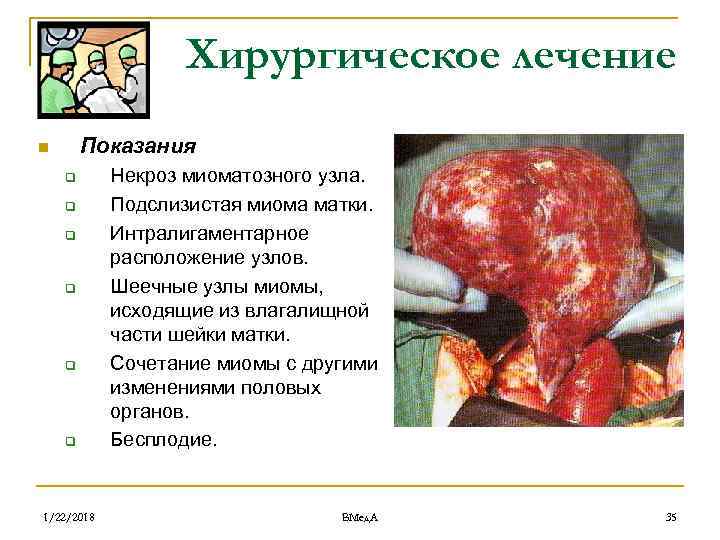     Хирургическое лечение n  Показания q  Некроз миоматозного узла.