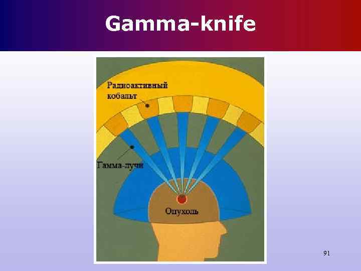 Gamma-knife 91 Gamma-knife 91
