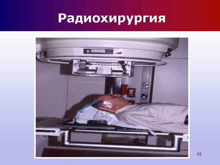 Радиохирургия 92 Радиохирургия 92