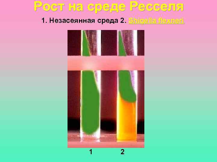 Рост на среде Ресселя 1. Незасеянная среда 2. Shigella flexneri    1