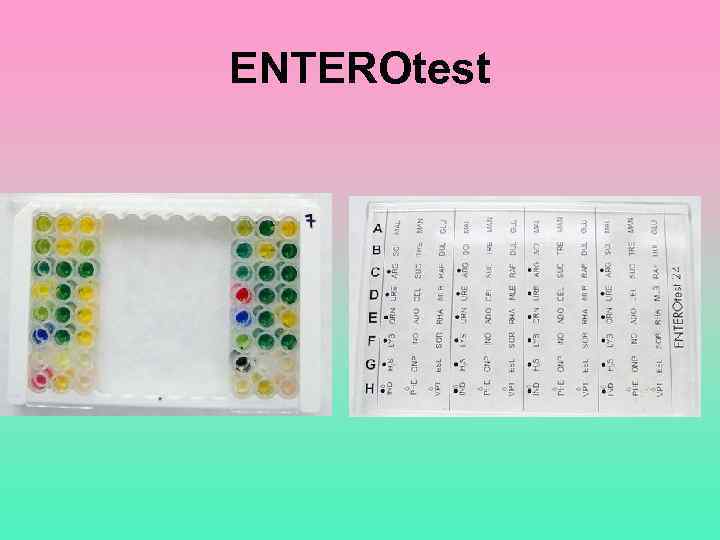 ENTEROtest 