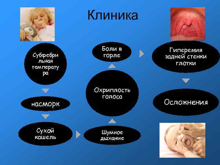 Клиника Боли в Гиперемия Субфебри горле задней стенки Клиника Боли в Гиперемия Субфебри горле задней стенки