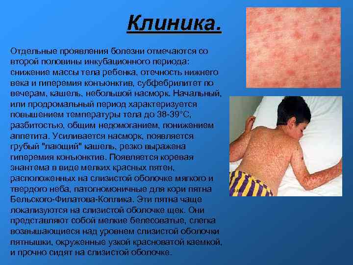 Клиника. Отдельные проявления болезни отмечаются со второй половины инкубационного Клиника. Отдельные проявления болезни отмечаются со второй половины инкубационного