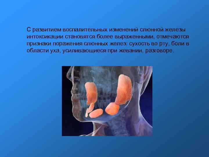С развитием воспалительных изменений слюнной железы интоксикации становятся более выраженными, отмечаются признаки поражения слюнных С развитием воспалительных изменений слюнной железы интоксикации становятся более выраженными, отмечаются признаки поражения слюнных