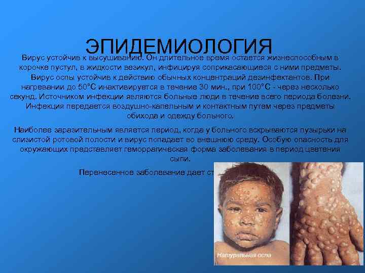 ЭПИДЕМИОЛОГИЯ Вирус устойчив к высушиванию. Он длительное время остается жизнеспособным ЭПИДЕМИОЛОГИЯ Вирус устойчив к высушиванию. Он длительное время остается жизнеспособным