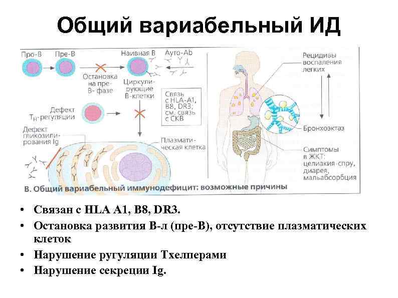  Общий вариабельный ИД • Связан с HLA A 1, B 8, DR 3.