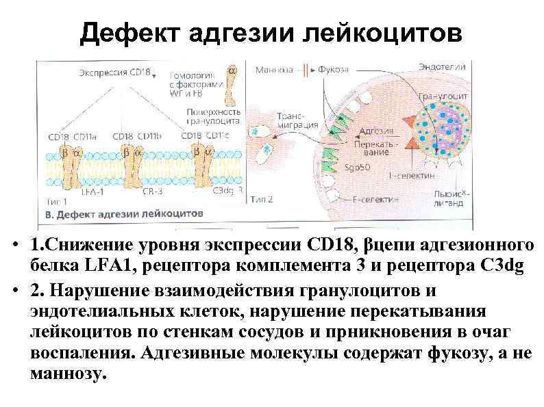   Дефект адгезии лейкоцитов • 1. Снижение уровня экспрессии CD 18, βцепи адгезионного