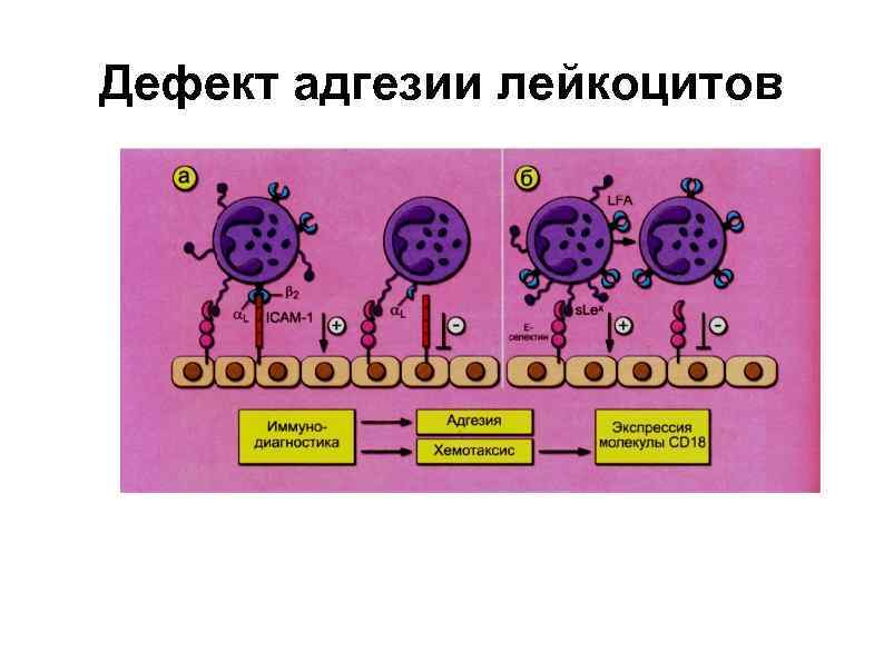 Строение хемотаксиса. Дефицит лейкоцитарной адгезии. Синдром дефицита адгезии лейкоцитов. Дефицит молекул адгезии лейкоцитов. Дефект адгезии лейкоцитов.