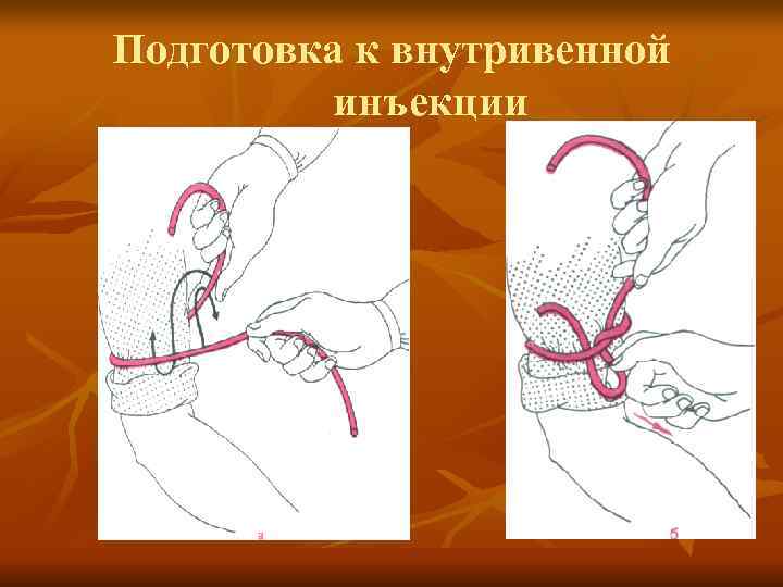 Внутривенные инъекции презентация