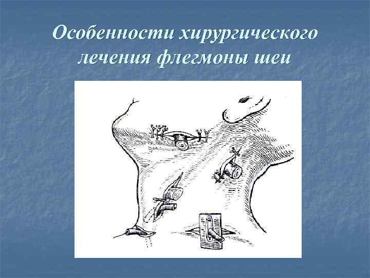 Особенности хирургического  лечения флегмоны шеи 