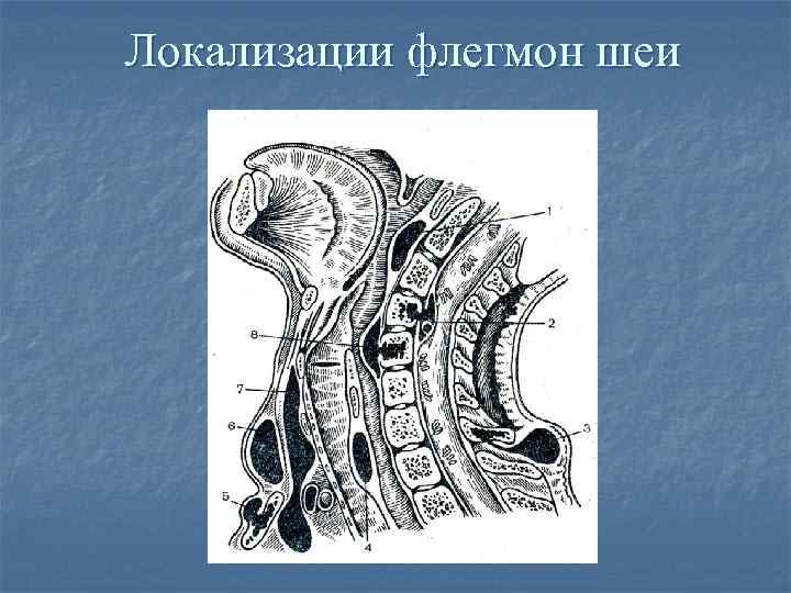Локализации флегмон шеи 