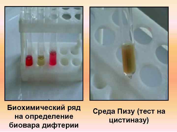 Биохимический ряд  Среда Пизу (тест на на определение   цистиназу) биовара дифтерии
