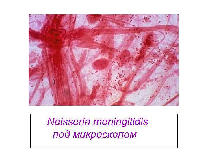  Neisseria meningitidis   под микроскопом 