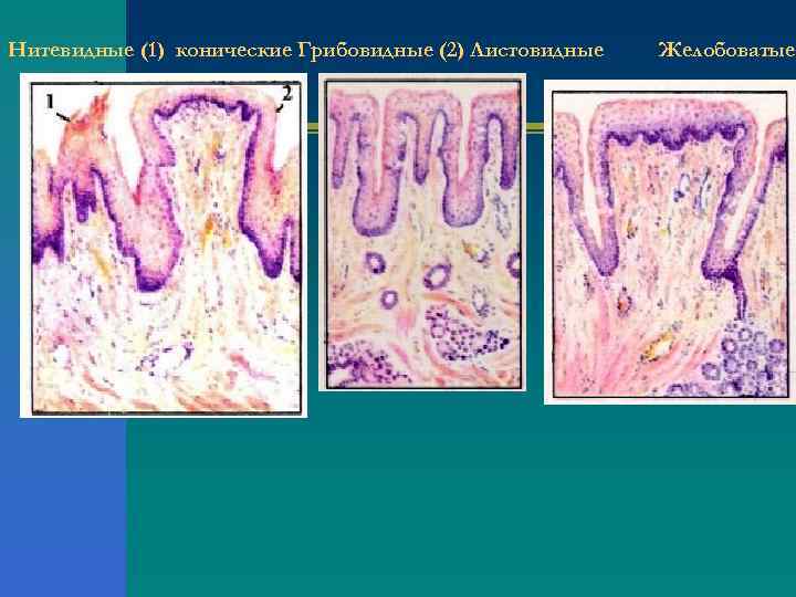 Нитевидные (1) конические Грибовидные (2) Листовидные  Желобоватые 