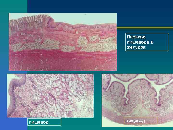    Переход  пищевода в  желудок пищевод 