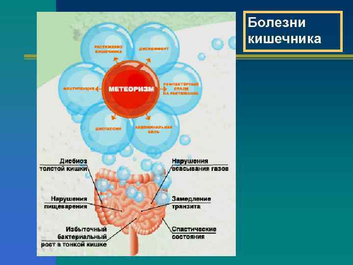 Болезни кишечника 
