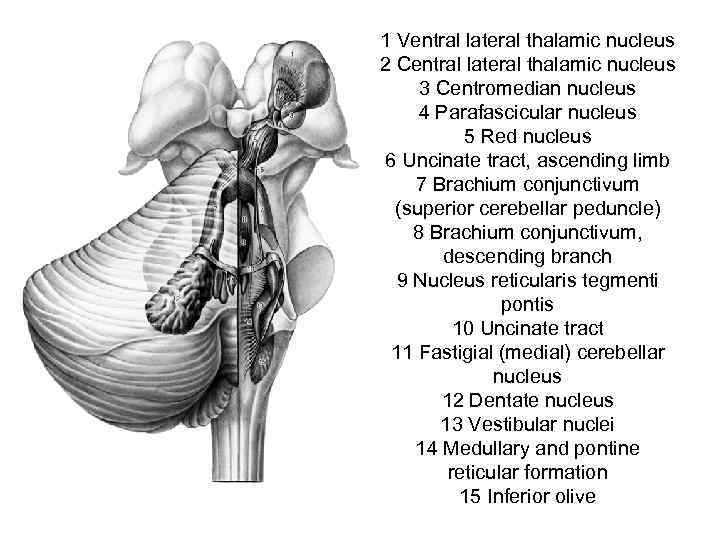 1 Ventral lateral thalamic nucleus 2 Central lateral thalamic nucleus 3 Centromedian nucleus 4